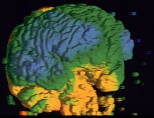 eeg1